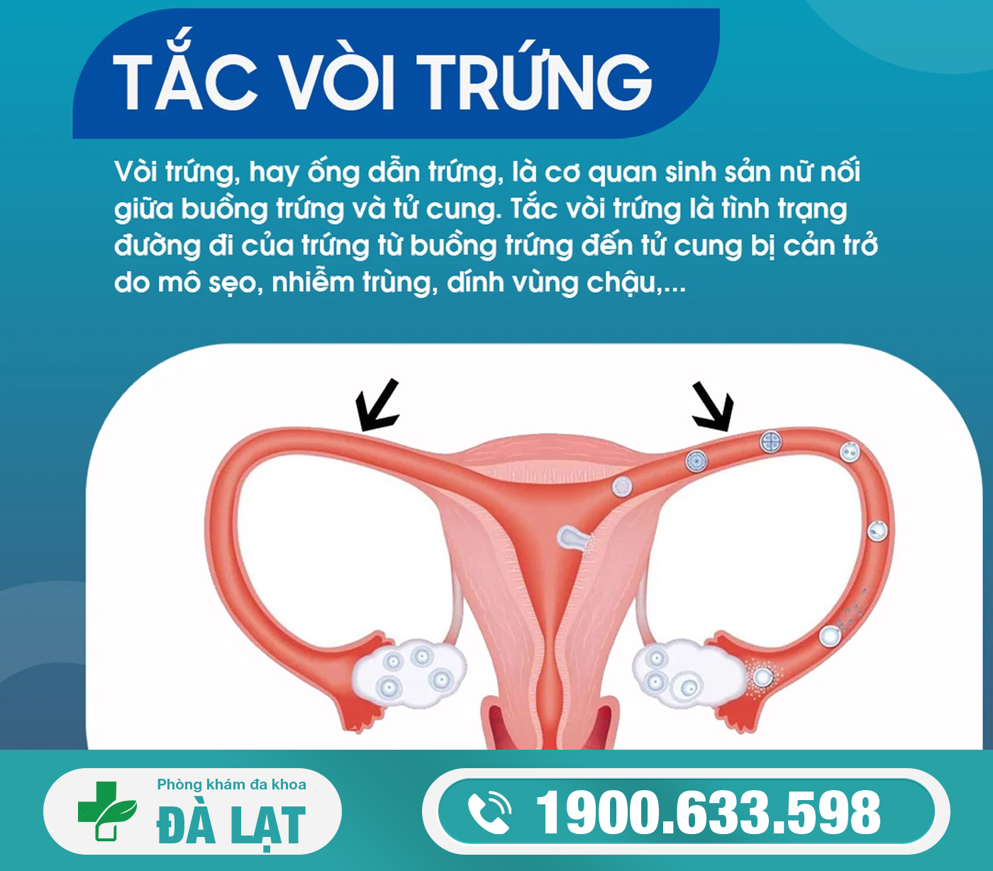 Hình ảnh minh họa